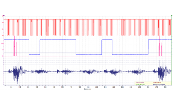 Эталон синхронизации-Сигнал ДПКВ + ДПРВ-BMW-X5 E53 1999 - 2006 : Image 1