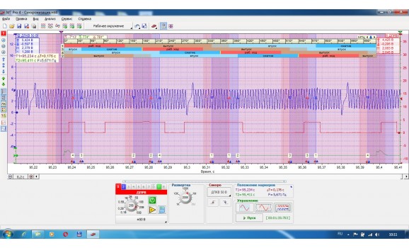 Эталон синхронизации-Сигнал ДПКВ + ДПРВ-Seat-Altea 2004 - 2015 : Image 1