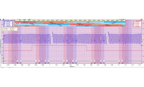 Эталон синхронизации-Сигнал ДПКВ + ДПРВ-Hyundai-Accent 4 (RB) 2010-2018 : Image 1