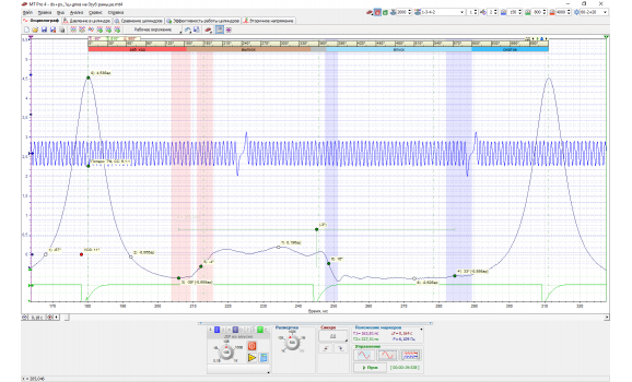 Эталон-Давление в цилиндре-Opel-Omega B1 1994–1999 : Image 1