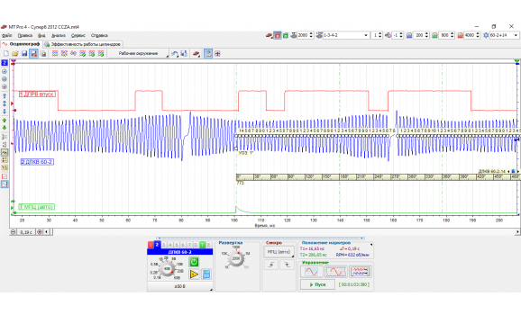 Эталон синхронизации-Сигнал ДПКВ + ДПРВ-Skoda-Superb B6 2008-2015 : Image 1