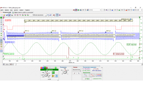 Эталон синхронизации-Сигнал ДПКВ + ДПРВ-Hyundai-Getz 2002-2011 : Image 1