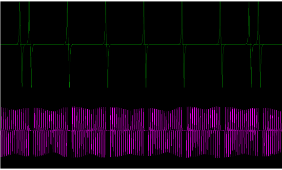 Эталон синхронизации-Сигнал ДПКВ + ДПРВ-Volvo-FH12 1 1993-2002 : Image 1
