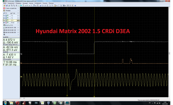 Good timing - CKP & CKM signal - Hyundai - Matrix 2001-2010 : Image 1