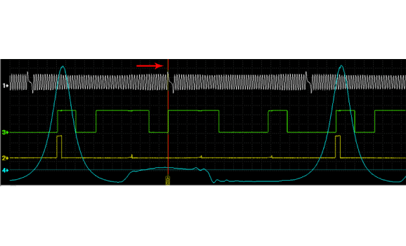 Эталон синхронизации - Сигнал ДПКВ + ДПРВ + ДД - Audi - A4 (B6) 2000–2006 : Image 1