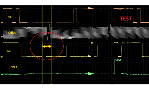 Эталон синхронизации - Сигнал ДПКВ + ДПРВ - Hummer - H3 2005-2010 : Image 1