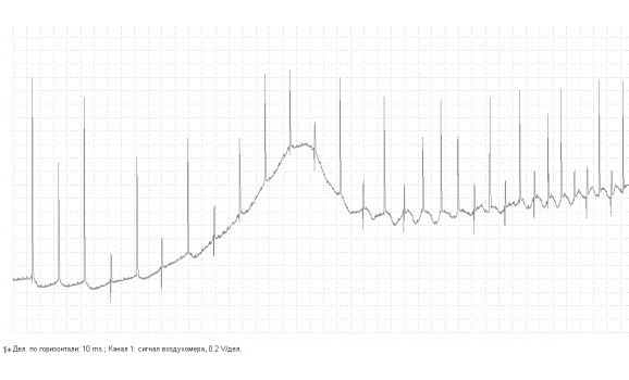 Неисправность ДМРВ - Выходное напряжение - Mercedes - W140 1991-1998 : Image 1